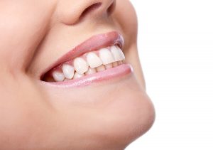 What Is Porcelain Inlays and Onlays in San Marcos Area