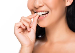 Teeth Veneers in San Marco CA Area