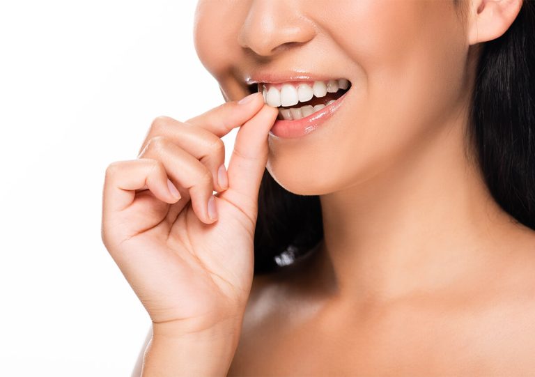 Teeth Veneers in San Marco CA Area