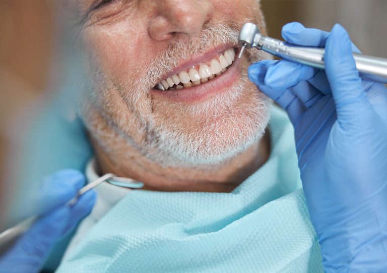Teeth Whitening for Smokers in San Marcos California Area
